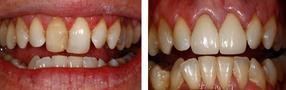 Dental patient photos in Countryside, IL
