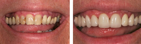Smile Gallery of Dr. Tony Cascino in Countryside, IL